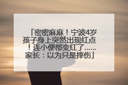 密密麻麻！宁波4岁孩子身上突然出现红点！连小便都变红了……家长：以为只是摔伤