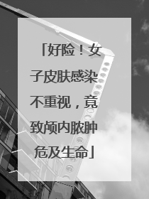 好险！女子皮肤感染不重视，竟致颅内脓肿危及生命